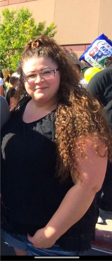 Weight Loss Transformation BEFORE Weight Loss Transformation BEFORE